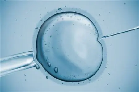 广州做试管婴儿可以放两个胚胎吗？(图1)