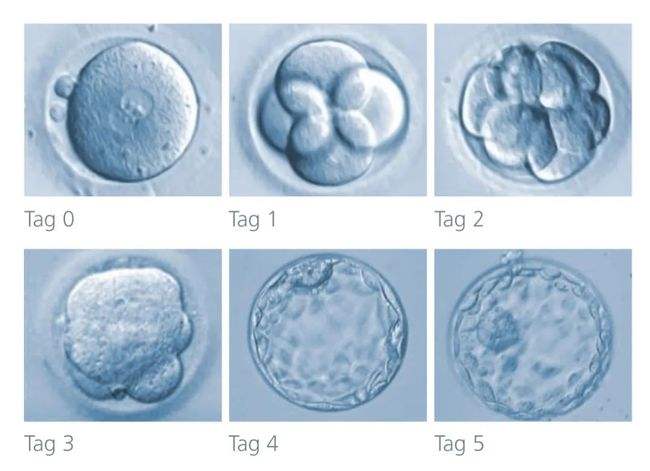 取卵后，胚胎在实验室都发生了什么？(图1)