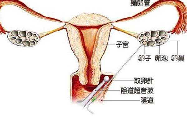 最低预算15万!俄罗斯第三代试管婴儿费用包含这(图2)