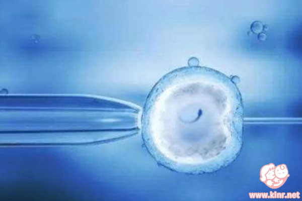 胚胎移植前为什么要憋尿呢