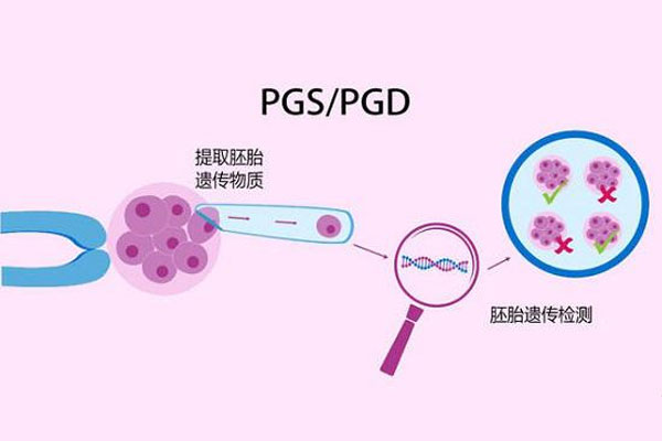 第三代试管婴儿技术又分为PGS和PGD