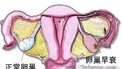 女人做了试管婴儿人就废了？好可怕，真的吗？(图2)