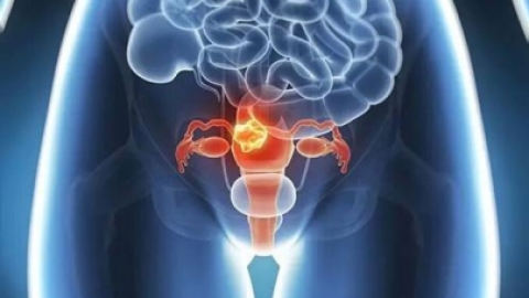 导致卵巢功能早衰的病因有那些及卵巢早衰的症