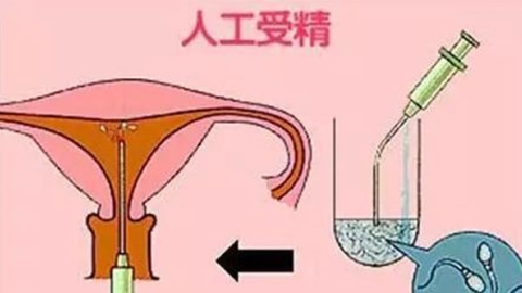 深圳人工授精费用低的6家医院盘点