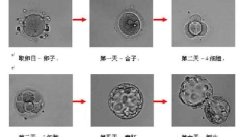 试管婴儿囊胚培养的这5大优势来看看，不止能提