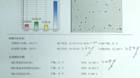 常规精液检查