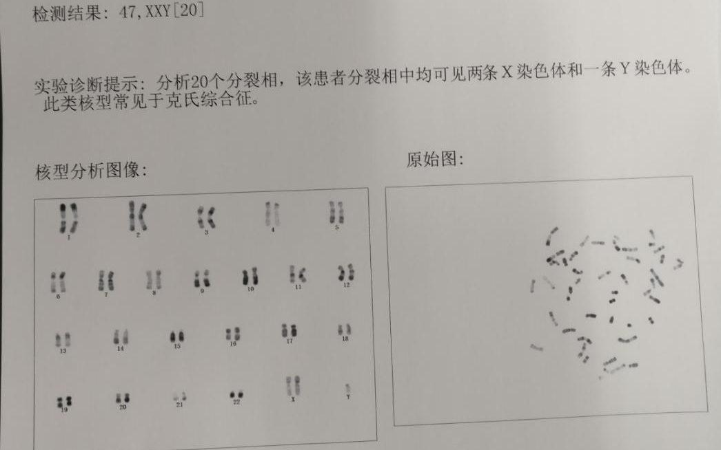 男性染色体异常是可以做试管婴儿的吗?