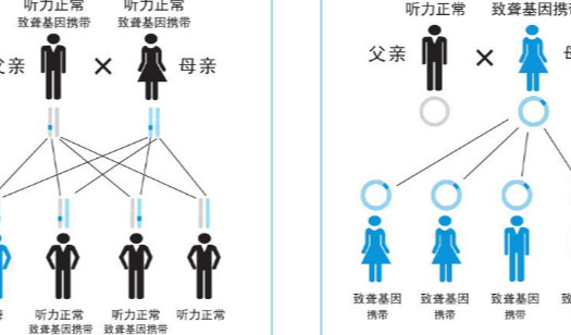 耳聋基因会遗传吗,可以去泰国做试管婴儿吗?