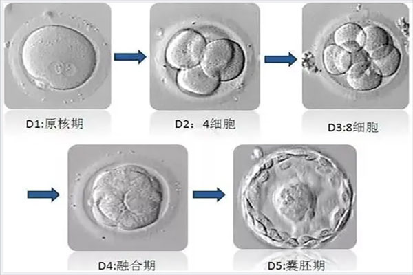 试管技术中鲜胚、囊胚、冻胚移植哪个成功率高?