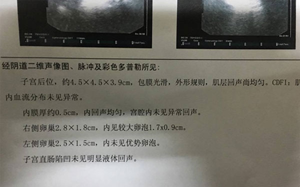 如何能知道卵泡破还是没破呢?彩超比b超更直观