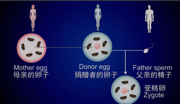 第四代试管婴儿属于什么技术