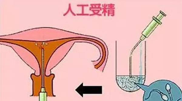 深圳人工授精费用低的6家医院盘点