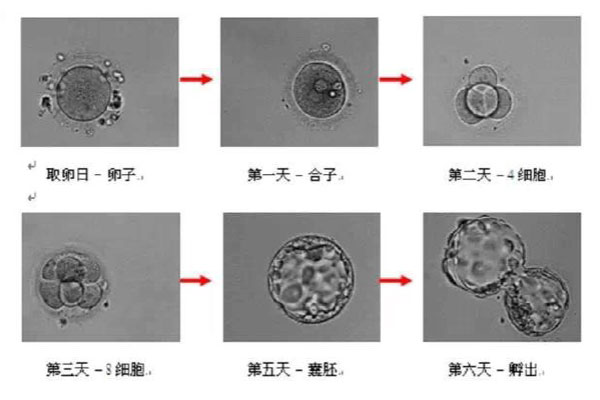 试管婴儿囊胚培养的这5大优势来看看,不止能提
