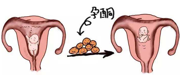 什么是孕酮？