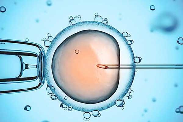 试管婴儿优生3法宝:PGD、PGS、NIPT